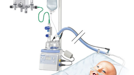 Bubble CPAP